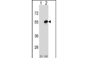 Western blot analysis of COCH (arrow) using rabbit polyclonal COCH Antibody (Center) (ABIN656833 and ABIN2846042). (COCH 抗体  (AA 399-428))