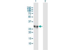 Western Blot analysis of PNMT expression in transfected 293T cell line by PNMT MaxPab polyclonal antibody.