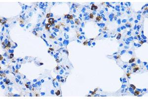 Immunohistochemistry of paraffin-embedded Rat lung using EEA1 Polyclonal Antibody at dilution of 1:100 (40x lens).