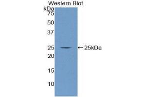 NUP160 antibody  (AA 11-206)
