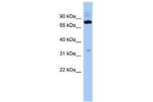 WB Suggested Anti-C14orf44 Antibody Titration: 0. (FAM161B 抗体  (Middle Region))