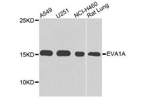 Western blot analysis of extracts of various cell lines, using EVA1A antibody. (TMEM166 抗体)