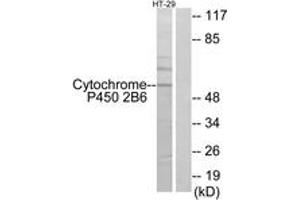Western blot analysis of extracts from HT-29 cells, using Cytochrome P450 2B6 Antibody. (CYP2B6 抗体  (AA 241-290))