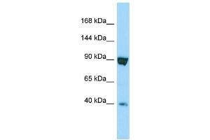 Western Blotting (WB) image for anti-Sperm Specific Antigen 2 (SSFA2) (C-Term) antibody (ABIN2790382) (SSFA2 抗体  (C-Term))