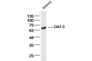 Mouse kidney lysates probed with OAT-3 Polyclonal Antibody, Unconjugated  at 1:300 dilution and 4˚C overnight incubation. (SLC22A8 抗体  (AA 31-110))