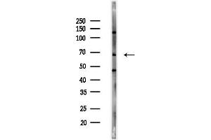 anti-Interleukin 1 Receptor Accessory Protein-Like 1 (IL1RAPL1) (N-Term) antibody