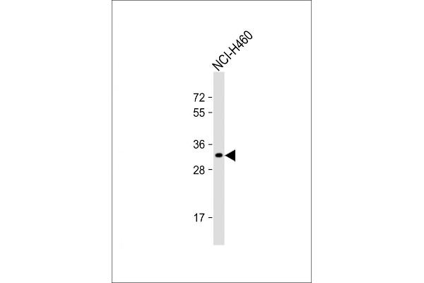 OR2B11 抗体  (C-Term)