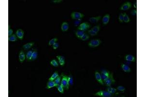 Immunofluorescent analysis of HepG2 cells using ABIN7173211 at dilution of 1:100 and Alexa Fluor 488-congugated AffiniPure Goat Anti-Rabbit IgG(H+L) (TMEM41A 抗体  (AA 18-66))