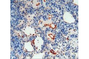 IHC-P analysis of lung tissue, with DAB staining. (Thrombomodulin 抗体  (AA 31-167))