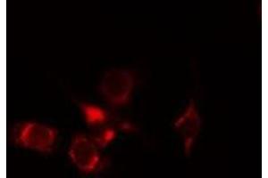 ABIN6275262 staining Hela cells by IF/ICC. (MYOM2 抗体  (Internal Region))