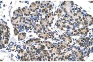 Immunohistochemical staining (Formalin-fixed paraffin-embedded sections) of human pancreas with DHX9 polyclonal antibody  at 4-8 ug/mL working concentration. (DHX9 抗体  (N-Term))