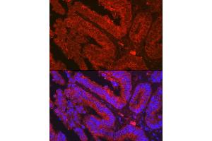 Immunofluorescence analysis of human colon carcinoma using OLFM4 Rabbit pAb (ABIN7269084) at dilution of 1:500 (40x lens). (Olfactomedin 4 抗体  (AA 211-510))