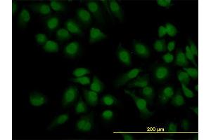 Immunofluorescence of monoclonal antibody to KIAA2002 on HeLa cell. (PEAK1 抗体  (AA 1151-1250))