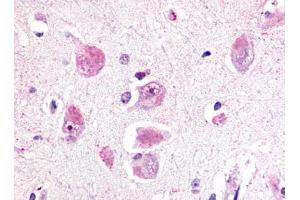 Immunohistochemical staining of Brain (Neurons and glia) using anti- RXFP3 antibody ABIN122238 (Relaxin 3 Receptor 1 抗体  (Cytoplasmic Domain))