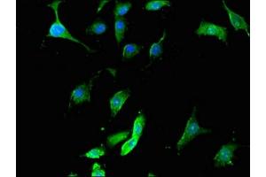 Immunofluorescent analysis of U251 cells using ABIN7168861 at dilution of 1:100 and Alexa Fluor 488-congugated AffiniPure Goat Anti-Rabbit IgG(H+L) (Septin 12 抗体  (AA 1-358))