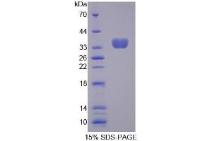 SDS-PAGE analysis of Mouse TCEA3 Protein. (TCEA3 蛋白)