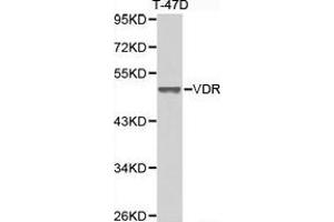 Western Blotting (WB) image for anti-Vitamin D Receptor (VDR) antibody (ABIN1875322) (Vitamin D Receptor 抗体)