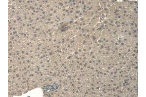 DAB staining on IHC-P; Samples: Mouse Liver Tissue (BNP 抗体  (AA 77-121))