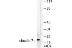 Western blot analysis of extracts from 293 cells, using Claudin 7 Antibody. (Claudin 7 抗体  (AA 162-211))
