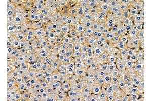 ABIN7095352 and ABIN7099409 at 1/100 staining mouse liver tissue by IHC-P. (SCARA5 抗体)