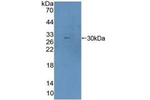 Detection of Recombinant AGA, Human using Polyclonal Antibody to Aspartylglucosaminidase (AGA) (AGA 抗体  (AA 28-245))