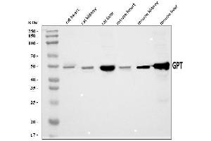 Western blot analysis of Alanine Transaminase/Gpt using anti-Alanine Transaminase/Gpt antibody (ABIN7600506).