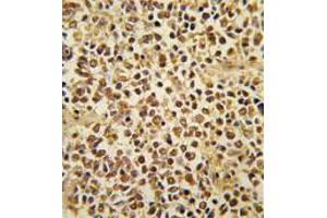 Image no. 3 for anti-SNAIL (SNAI1) (N-Term) antibody (ABIN357449)