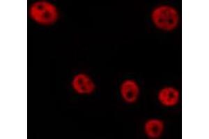 ABIN6268976 staining Hela by IF/ICC. (Cyclin D2 抗体  (pThr280))