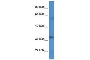Western Blot showing BCO2 antibody used at a concentration of 1 ug/ml against HT1080 Cell Lysate (BCO2 抗体  (C-Term))