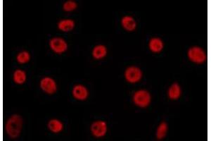 ABIN6266655 staining 293 by IF/ICC. (PIAS3 抗体  (N-Term))