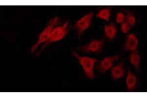 Immunofluorescence (fixed cells) (IF/ICC) image for anti-Ubiquitin Carboxyl-terminal Esterase L1 (Ubiquitin Thiolesterase) (UCHL1) (C-Term) antibody (ABIN6264167)