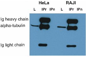 Immunoprecipitation of alpha-tubulin from HeLa and RAJI cell lysate by antibody TU-16 and its detection by antibody. (alpha Tubulin 抗体)