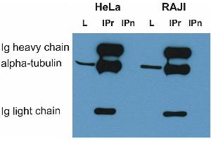 Immunoprecipitation of alpha-tubulin from HeLa and RAJI cell lysate by antibody TU-16 and its detection by antibody.