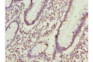 Immunohistochemistry of paraffin-embedded human small intestine tissue using ABIN7143435 at dilution of 1:100 (ADPGK 抗体  (AA 218-497))