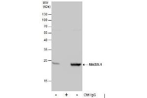 IP Image Immunoprecipitation of MAD2L1 protein from 293T whole cell extracts using 5 μg of MAD2L1 antibody [C2C3], C-term, Western blot analysis was performed using MAD2L1 antibody [C2C3], C-term, EasyBlot anti-Rabbit IgG  was used as a secondary reagent. (MAD2L1 抗体  (C-Term))