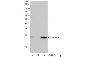 IP Image Immunoprecipitation of MAD2L1 protein from 293T whole cell extracts using 5 μg of MAD2L1 antibody [C2C3], C-term, Western blot analysis was performed using MAD2L1 antibody [C2C3], C-term, EasyBlot anti-Rabbit IgG  was used as a secondary reagent.
