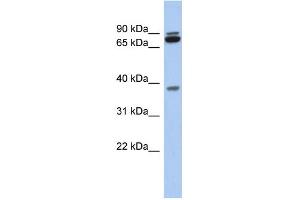 WB Suggested Anti-MGC70924 Antibody Titration: 0. (PRR19 抗体  (Middle Region))