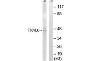 Western blot analysis of extracts from Jurkat cells, using FOXD4/L2/L3/L4/L5/L6 Antibody. (FOXD4/L2/L3/L4/L5/L6 抗体  (AA 281-330))