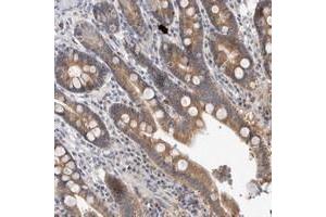 Immunohistochemical staining of human duodenum with MRPL37 polyclonal antibody  shows moderate cytoplasmic positivity in glandular cells. (MRPL37 抗体)