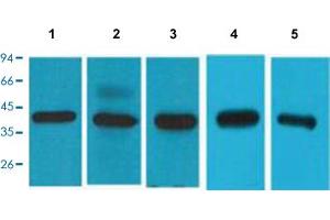 Western Blot analysis of lane 1: 293T cell, Lane 2: HeLa cell, Lane 3: HepG2 cell, Lane 4: mouse brain and Lane 5: rat brain. (EIF4A1 抗体  (C-Term))