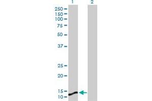 Western Blot analysis of MGST1 expression in transfected 293T cell line by MGST1 MaxPab polyclonal antibody. (MGST1 抗体  (AA 1-155))