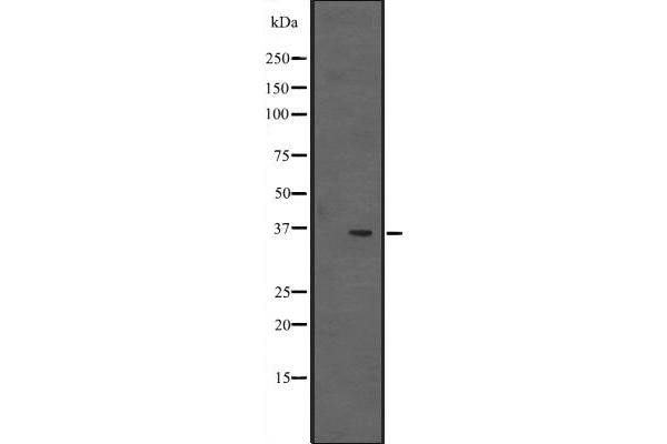 EBNA1BP2 抗体  (Internal Region)
