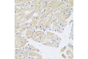 Immunohistochemistry (Paraffin-embedded Sections) (IHC (p)) image for anti-Transglutaminase 5 (TGM5) (AA 461-720) antibody (ABIN6149097)