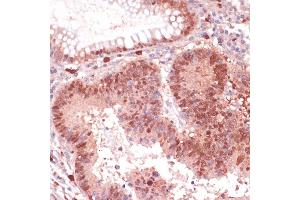 Immunohistochemistry (IHC) image for anti-S100 Calcium Binding Protein P (S100P) (AA 1-95) antibody (ABIN7270133)