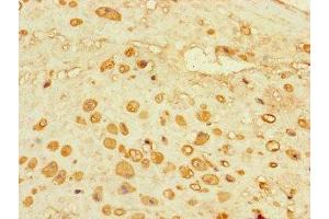 Immunohistochemistry of paraffin-embedded human placenta tissue using ABIN7143303 at dilution of 1:100