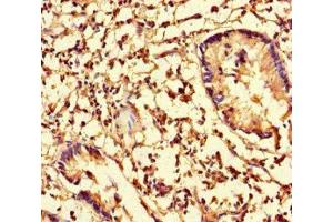 Immunohistochemistry of paraffin-embedded human appendix tissue using ABIN7148044 at dilution of 1:100 (Cofilin 抗体  (AA 4-144))