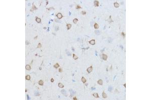 Immunohistochemistry of paraffin-embedded Mouse brain using CCT8 antibody (ABIN1679065, ABIN3018943, ABIN3018944 and ABIN6220637) at dilution of 1:100 (40x lens). (CCT8 抗体  (AA 248-497))