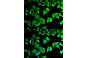 Immunofluorescence (IF) image for anti-Ribosomal Protein S12 (RPS12) antibody (ABIN1980257) (RPS12 抗体)