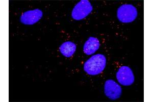 Proximity Ligation Analysis of protein-protein interactions between CCNB1 and PKMYT1. (Cyclin B1 抗体  (AA 1-433))