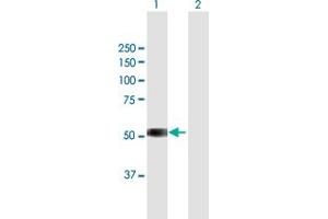 Western Blot analysis of TSPYL6 expression in transfected 293T cell line by TSPYL6 MaxPab polyclonal antibody. (TSPY-Like 6 抗体  (AA 1-410))
